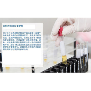 แผ่นรีเอเจนต์ URS-11 สำหรับการตรวจปัสสาวะ 100 แผ่น ความสามารถในการป้องกันการรบกวนจากสาร VC สำหรับการทดสอบทางการแพทย์ - Product Image 2