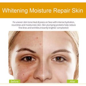 Actory itititititamin ACE erum Kin kin are nnti GE ACE hitace hitening rirefresca <span class=keywords><strong>la</strong></span> piel uidado e IEL it CID yaluronic CID erum - Product Image 3