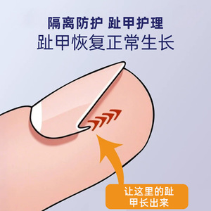 Xinzhangmen Toenail Care Isolation <b>Pads</b> 10pcs/box Nail Groove Corrector Ingrown Toenail Patch Assistive Toenail - Product Image 2