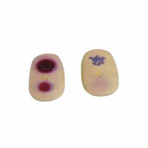 KyrenMed Módulo de Lesión de Viruela, Modelo de Piel Enferma por Virus de la Viruela, Paquete de 2 Piezas - Product Image 1