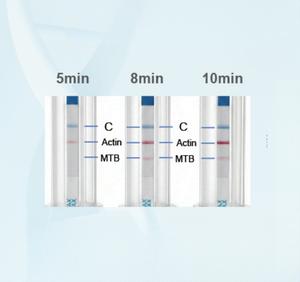 Kit de Prueba Rápida de Ácido Nucleico RPA LFA, Sensibilidad a Nivel PCR, Detección Rápida en 8 Minutos, Reactivo de Diagnóstico Molecular Multiplex - Product Image 2