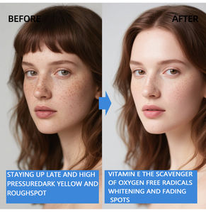 Kapsul lembut <span class=keywords><strong>Vitamin</strong></span> <span class=keywords><strong>E</strong></span> Whale hidup 120 mg-oem/ODM sumber pabrik untuk kustomisasi Label pribadi - Product Image 5