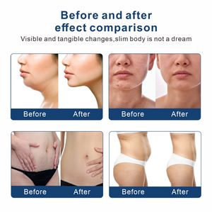 Prix Usine Nouveautés Appareil de Beauté 2-en-1 <span class=keywords><strong>à</strong></span> <span class=keywords><strong>Radiofréquence</strong></span> <span class=keywords><strong>Fractionnée</strong></span> Or pour Raffermissement Cutané, Anti-rides et Lifting Facial, avec Fonction Froid - Product Image 6