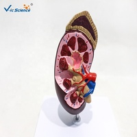 Modèle anatomique de rein humain démontable en PVC pour la néphrologie clinique et la démonstration pédagogique en anatomie CE/ISO/ROHS/CNAS