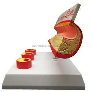 Modelo de Progresión de la Aterosclerosis con Secciones de 3 Etapas para la Enseñanza de Cardiología - Product Image 2