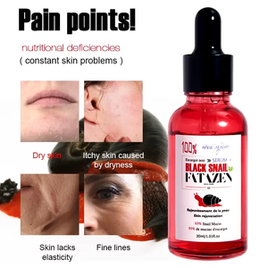 Sérum <span class=keywords><strong>de</strong></span> visage d'escargot réparateur anti-âge anti-âge pour l'élimination des <span class=keywords><strong>taches</strong></span> <span class=keywords><strong>brunes</strong></span> Sérum <span class=keywords><strong>de</strong></span> visage coréen hydratant anti-cône d'escargot noir <span class=keywords><strong>de</strong></span> marque privée - Product Image 3