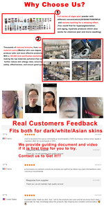 Kit Profesional <span class=keywords><strong>de</strong></span> Bio Microneedling 50% con <span class=keywords><strong>Peeling</strong></span> Herbal <span class=keywords><strong>de</strong></span> <span class=keywords><strong>Algas</strong></span> para Tratamiento <span class=keywords><strong>de</strong></span> Espículas <span class=keywords><strong>de</strong></span> Espongilla - Product Image 4