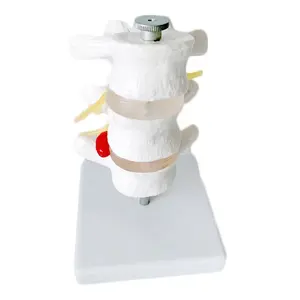 3 척추 인간 요추 디스크 추간판 탈출증 모델 척추 지압사를 위한 분리형 척추 기둥