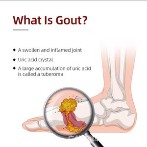 Spray de traitement de la fasciite plantaire à base de plantes 1fl.oz pour la douleur au talon du matin - Product Image 6