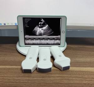 Minbrand marka prob 192 eleman 3 in 1 çift kafa kablosuz prob ultrason kablosuz renkli Doppler 3 in 1 prob - Product Image 2