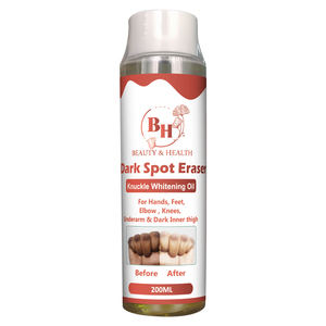 Aceite Blanqueador de Semillas de Vitamina E Frescas de Marca Privada, Reducción Efectiva de Manchas Oscuras, Reducción de Melanina, Blanqueamiento de Piernas y Codos, Esencial Puro - Product Image 2