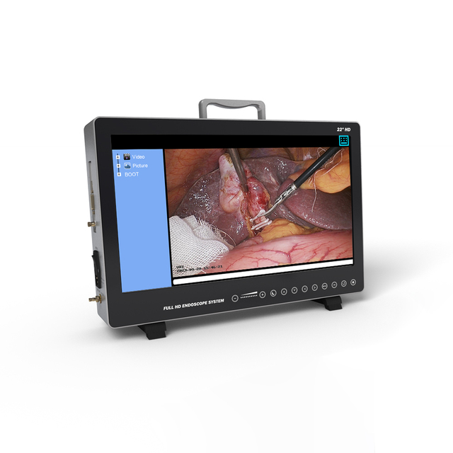 IKEDA Portable Electric HD Endoscopic Camera Medical Imaging Equipment for ENT/Laparoscopy/Hysteroscopy/Urology