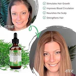 Aceite de Romero para el crecimiento del cabello 100% aceite de Romero prensado en frío natural para aromaterapia de la piel para mujeres y hombres - Product Image 6