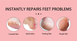 ถุงเท้าเจลสำหรับการดูแลเท้าประจำวันและปรับปรุงสภาพผิวด้วยการออกแบบที่น้ำหนักเบาและช่วยรักษาความชุ่มชื้น - Product Image 3