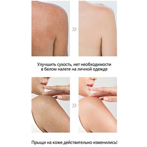 Loción Corporal Hidratante de 500 ml a Bajo Precio, Crema Corporal Aclarante con Ácido Kójico, Lociones Corporales Humectantes y Blanqueadoras para Mujeres - Product Image 2