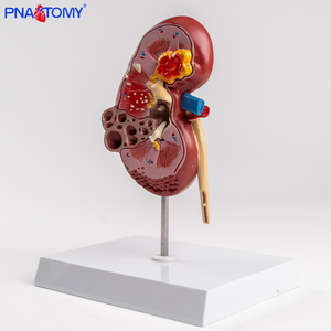 Modello Anatomico di Reni Normali e Malati a Grandezza Naturale, Strumento Didattico per il Sistema Urinario, Attrezzatura Educativa, Regalo Medico - Product Image 3