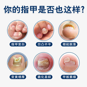 โอตซานียา เกรย์ เนล นาโน ซิลเวอร์ ลิควิด 30 มล. สำหรับเล็บแข็งแรง ดูแลเล็บมือ - Product Image 2