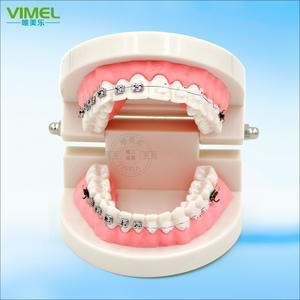 Modelo Dental de Ortodoncia, Brackets Semi-Cerámicos Semi-Metálicos, Implante de Plástico, Prótesis para la Comunicación Médico-Paciente y la Enseñanza - Product Image 2