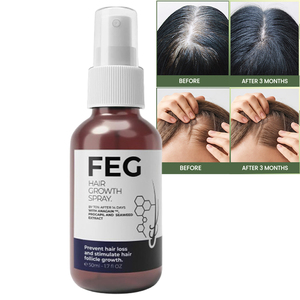 Serum penumbuh rambut pria dan wanita, minyak penumbuh rambut organik alami 100% Label pribadi - Product Image 1