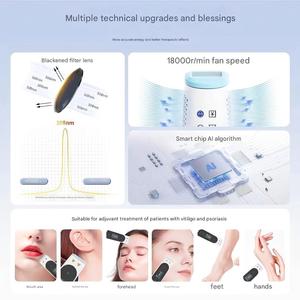 Nueva Llegada Península <span class=keywords><strong>L</strong></span> ED Excimer Vitiligo LED 308nm Excimer Laser 308nm UVB PARA EL Hogar Psoriasis Tratamiento Uvb Fototerapia - Product Image 6