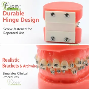 Modèle orthodontique d'inalignement dentaire, modèle de démonstration de malalignement dentaire avec supports pour la formation et l'éducation des dentistes - Product Image 4