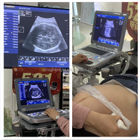 128 elemen resolusi tinggi warna Doppler mesin Ultrasound cerdas 3D/4D Notebook Ultrasound USG