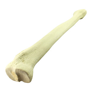 Menselijk Skelet Model Humerus Tibia Heupgewricht Model Orthopedische Implantatie Simulatie Chirurgie Simulatie Zaagbeen