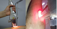 Peralatan Penghilang Bulu Laser Dioda Pulsa Panjang Hotlaser 755nm Pengencangan Kulit untuk Pusat Kecantikan Teknologi VCSEL Penggunaan Komersial