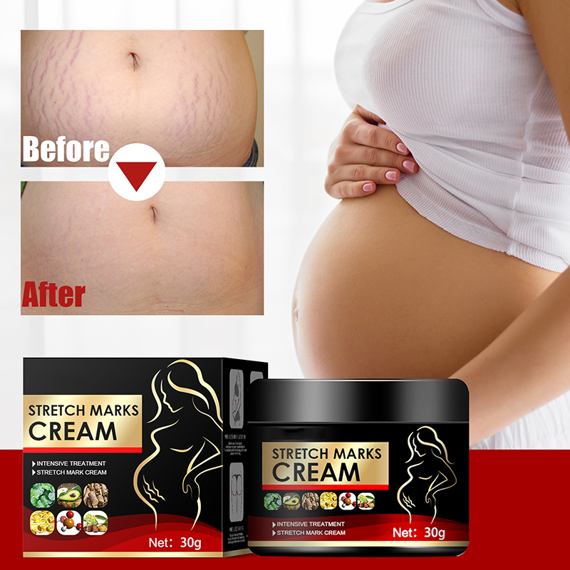 natural organic skin repair anti vergeture for pregnancy repair scar mark stretch mark remover cream