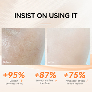 Suero Facial Antienvejecimiento con Vitamina C LANBENA para Iluminar, Blanquear e Hidratar la Piel 30ml - Product Image 6
