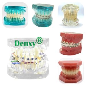 Modello dentale Denxy con staffa metallica legatura legatura catena elastica orto Typodont dentale per trattamento di dimostrazione ortodontica - Product Image 4