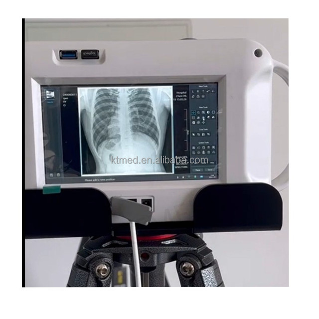 Medical Handheld X-Ray Machine Portable Vet X-Ray Radiography System  Touch Screen Handheld X-ray Machine