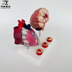 Model pengajaran demonstrasi penyakit kardiovaskular manusia dan rustiker dengan usia - Product Image 5