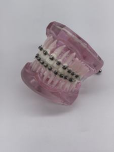 Bracket Ortodontik Power Chain untuk Gigi, Kawat Ortodonti, Bracket Self-ligating, Ligatur Tie - Product Image 3