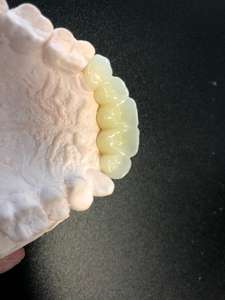 Denti Artificiali <span class=keywords><strong>in</strong></span> Resina Personalizzati con Alimentazione Elettrica per Tutti dai Laboratori Dentali Cinesi - Product Image 4