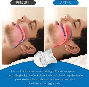 男性と女性のためのいびき防止装置マウスピースマウスガード、舌保持いびきソリューション - Product Image 2