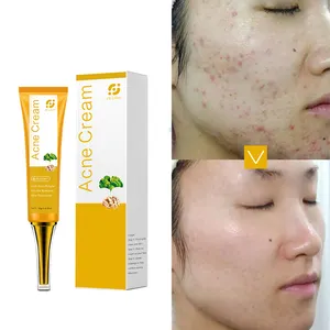 coreano di marca di crema per il viso sbiancante Suppliers-Crema per l'acne del viso con etichetta privata