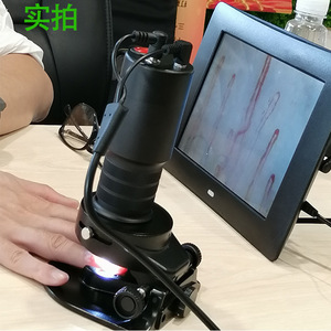 เครื่องตรวจจับการไหลเวียนโลหิตระดับไมโคร Godly Blood รุ่น DMX980-1 อุปกรณ์ถ่ายภาพเส้นเลือดฝอยบนเล็บระดับมืออาชีพ - Product Image 1