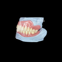 Laboratoire dentaire chinois, prothèse complète personnalisée, prothèses complètes en acrylique, service de traitement numérique CAD CAM pour les laboratoires dentaires STL