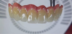 BAOT PFM céramique Incisal <span class=keywords><strong>émail</strong></span> E-1B 50g dentisterie distributeur de matériel <span class=keywords><strong>dentaire</strong></span> poudre de porcelaine laboratoire <span class=keywords><strong>dentaire</strong></span> - Product Image 6