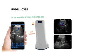 Sonda de Ultrasonido Convexa Portátil C38B con Certificación CE R60 192E de 3.5 y 5 MHz, <span class=keywords><strong>Doppler</strong></span> Color, Veterinaria/Humana, para Abdomen - Product Image 2