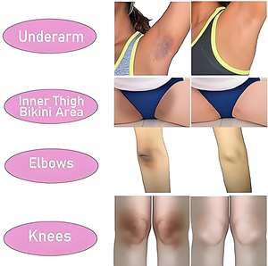 Крем для осветления кожи для темных подмышек, колен, локтей, внутренней части бедра, линии бикини, отбеливающий крем для области подмышек - Product Image 2