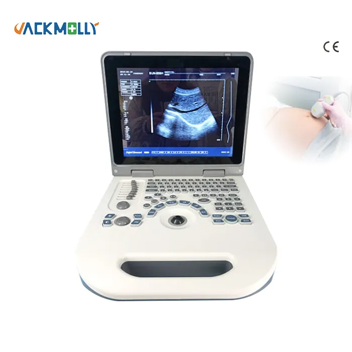 Sonar portátil ultrasónico para uso humano, diagnóstico médico, máquina portátil, de ultrasonido, de uso médico, de 2 a 3