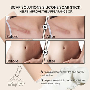 Tongkat bekas luka silikon untuk wajah dan tubuh dengan Centella Asiatica Vitamin E menenangkan pelembab bekas luka perawatan untuk bekas luka baru lama OEM - Product Image 4