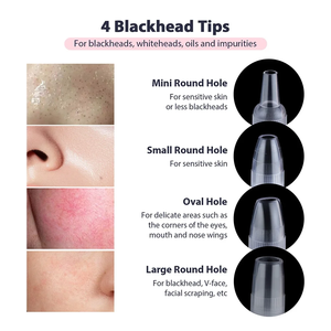 Dispositivo Facial, Otro Equipo de Belleza para Uso Doméstico, Dispositivos Faciales para el Cuidado de la Piel, Dispositivo Portátil de Limpieza Facial Frío y Caliente - Product Image 5