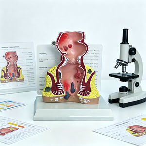 Modello Anatomico di Emorroidi Anorettali Umane con Malattie Rettali Comuni per l'Insegnamento in Gastroenterologia - Product Image 3