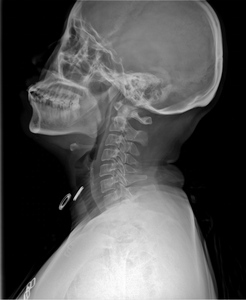 <span class=keywords><strong>Dr</strong></span> плоский детектор Rayos Xflat Panel Rayos Xrayos X Portatil - Product Image 3