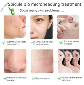 Polvere Esfoliante di Alghe Rosa S 80% con Spicule di Spongilla per Terapia Bio-Microneedling - Per Centri Estetici e Saloni di Bellezza - Product Image 6