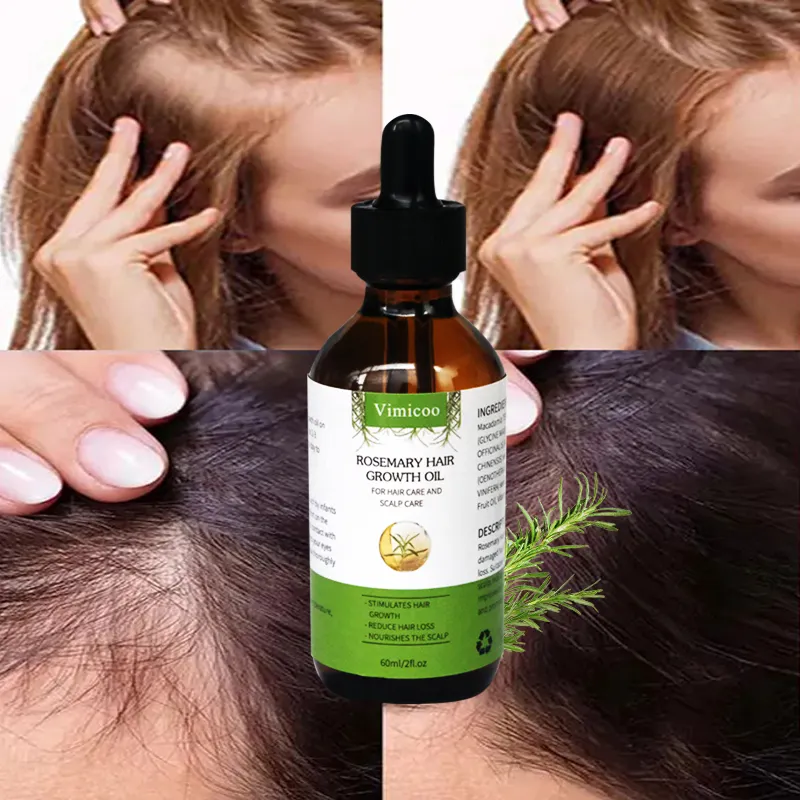 Customized Logo Natural Nourishing Repair Scalp Reducing Loss Brightening Hair Care Oil Rosemary Hair Growth Oil