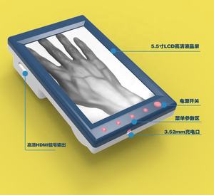 VF10 diskon besar-besaran 5 "penampil Nadi Portabel Tampilan LCD untuk injeksi anak dan dewasa - Product Image 4